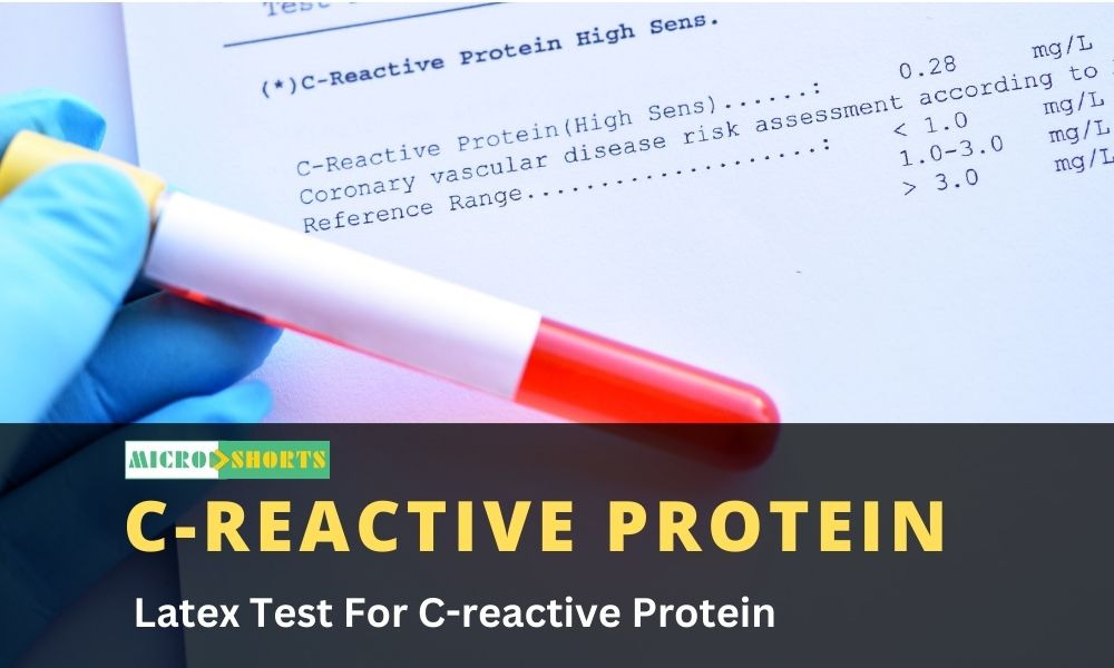 Latex Test For C-reactive Protein