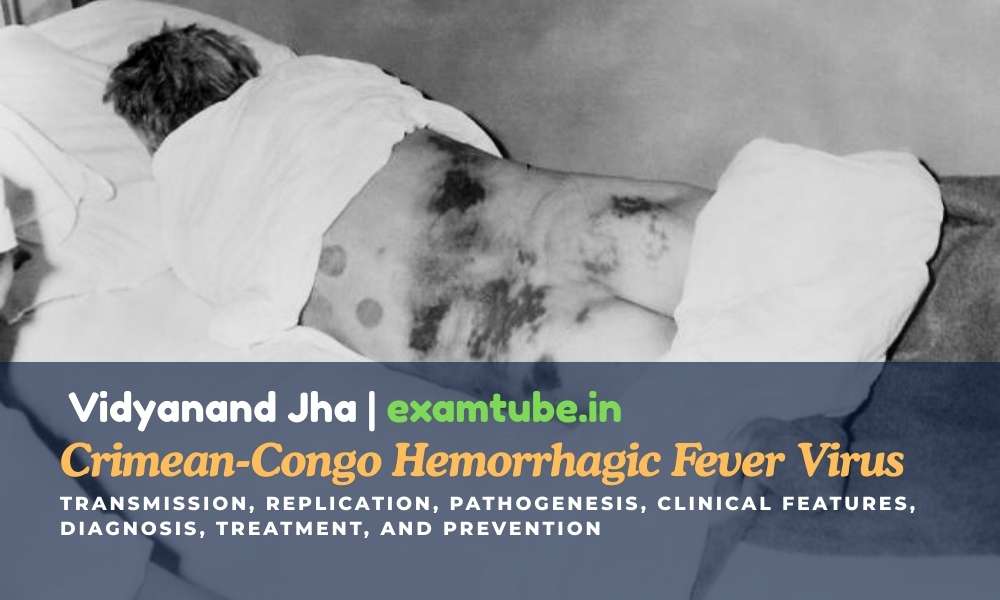 Crimean-Congo Hemorrhagic Fever Virus (CCHFV): Transmission, Replication, Pathogenesis, Clinical Features, Diagnosis, Treatment, and Prevention