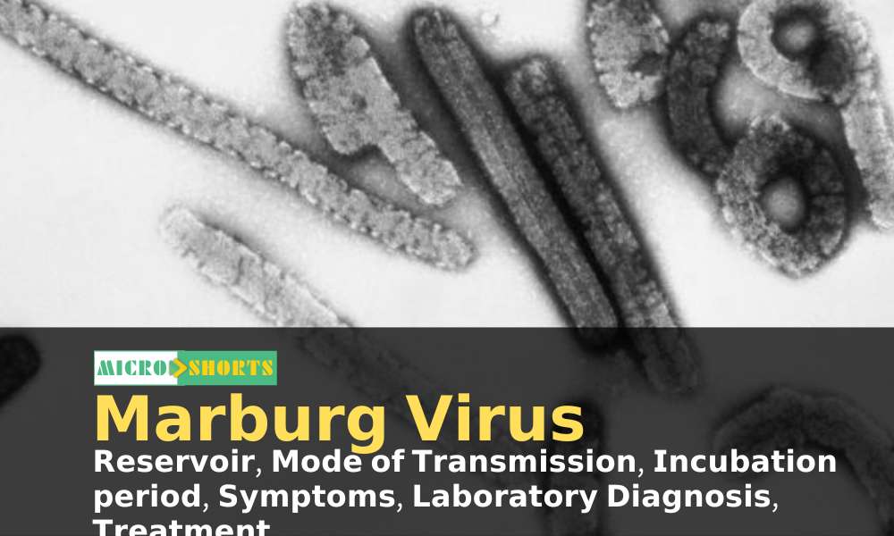 Marburg Virus – Reservoir, Mode of transmission, Incubation Period, Symptom, Laboratory Diagnosis, Treatment